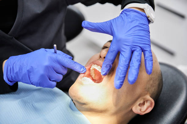 Best Walk-In Emergency Dental Services in St James City, FL